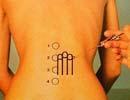 Neuraltherapie